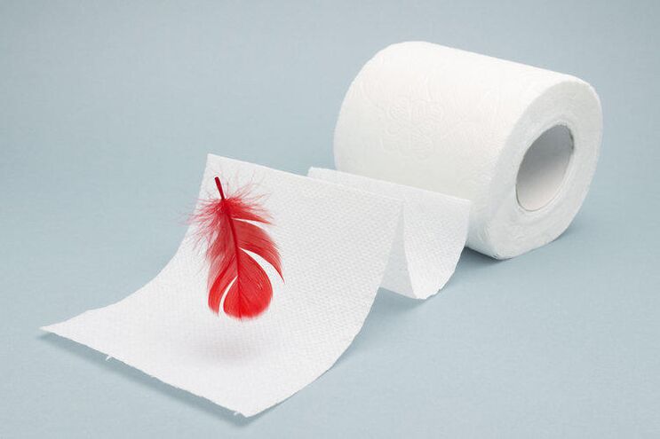Blood in toilet paper is a sign of hemorrhoids